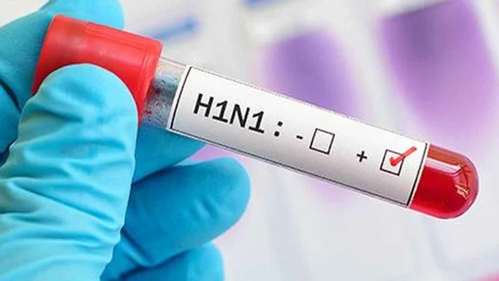 H1N1 influenza swine flu symptoms treatment