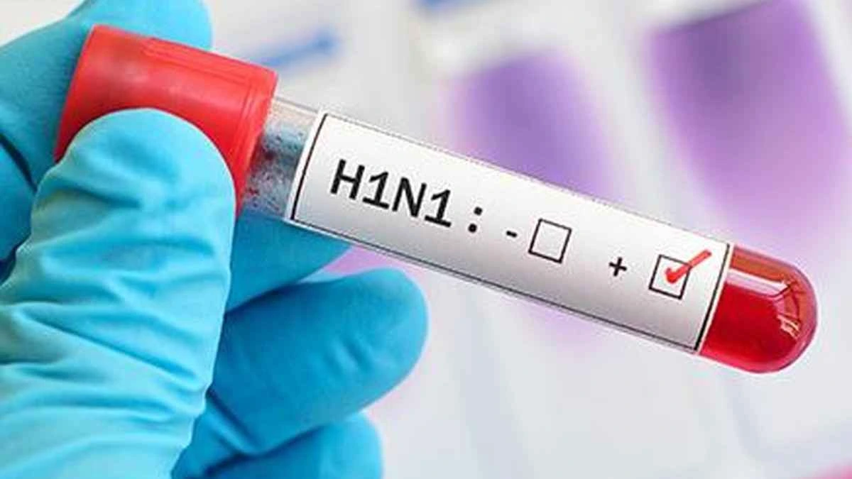 H1N1 का दिल्ली समेत कई राज्यों में कहर, इन 7 लक्षणों को न करें नजरअंदाज-जानिए बचाव
